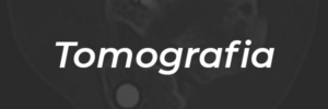Tomografia